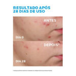 serum-facial-la-roche-posay-effaclar-ultra-concentrado-1-700×700